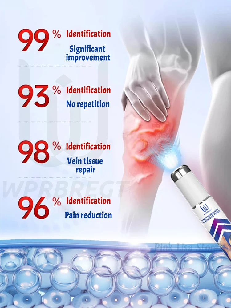 2nd Gen Varicose Vein Laser Therapy Device – Relieves Spider Leg Pain, Treats Vasculitis & Phlebitis