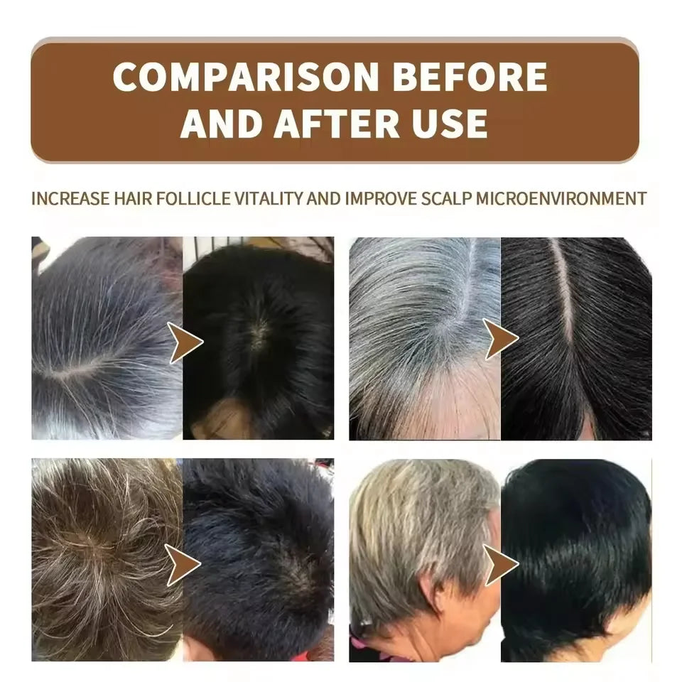 Gray to Black Hair Treatment Serum – Natural Hair Color Repair Spray for Hair Loss & Healthy Hair Care