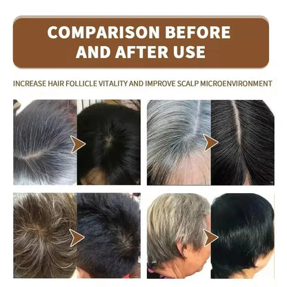 Gray to Black Hair Treatment Serum – Natural Hair Color Repair Spray for Hair Loss & Healthy Hair Care