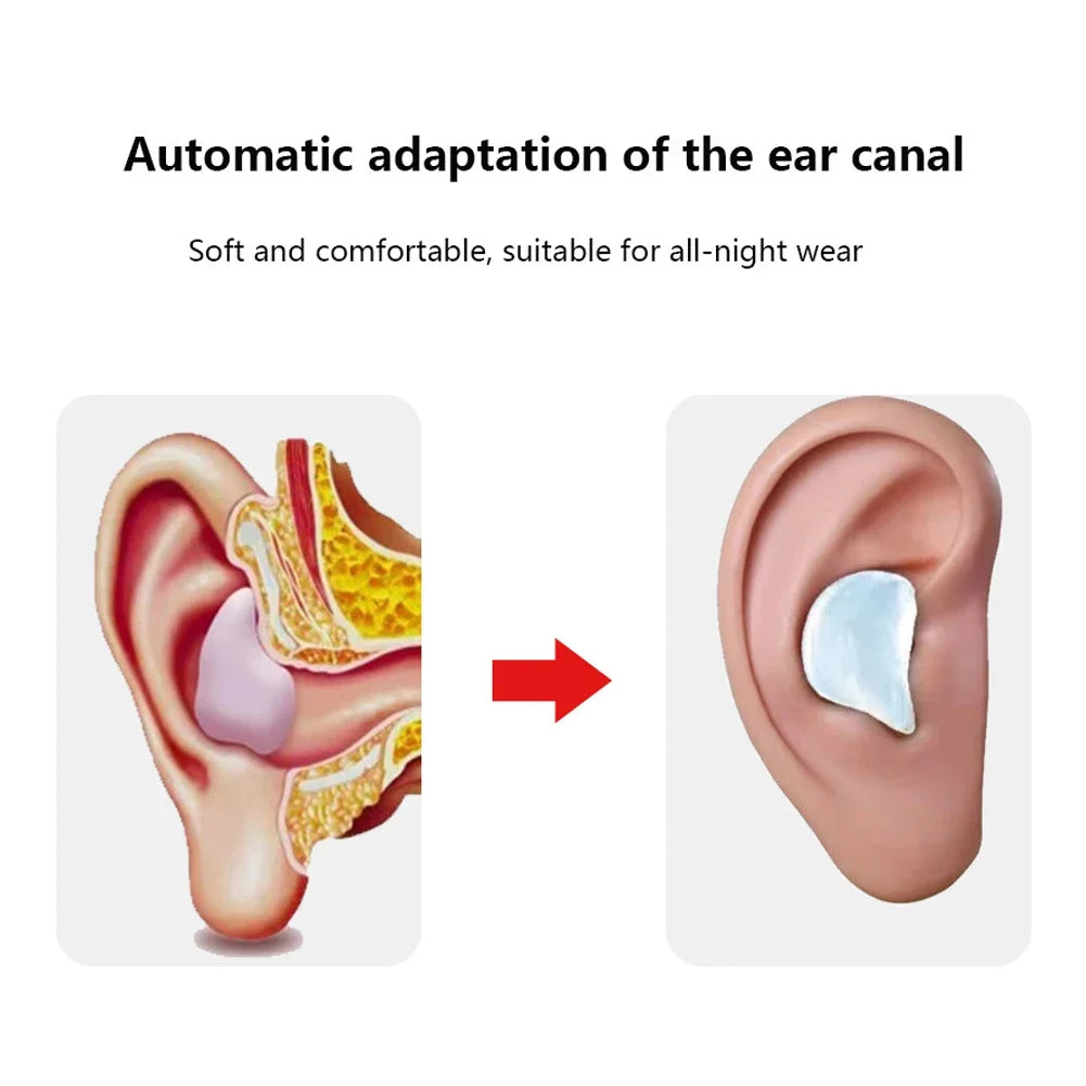Silicone Earplugs – Moldable Noise-Reducing Ear Protection for Sleeping, Travel & Swimming
