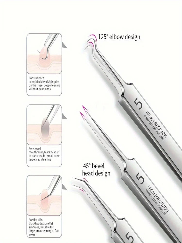 1/3/8PCS Stainless Steel Blackhead Removal Tool Set – Facial Tweezers, Acne Needles & Beauty Blackhead Removers
