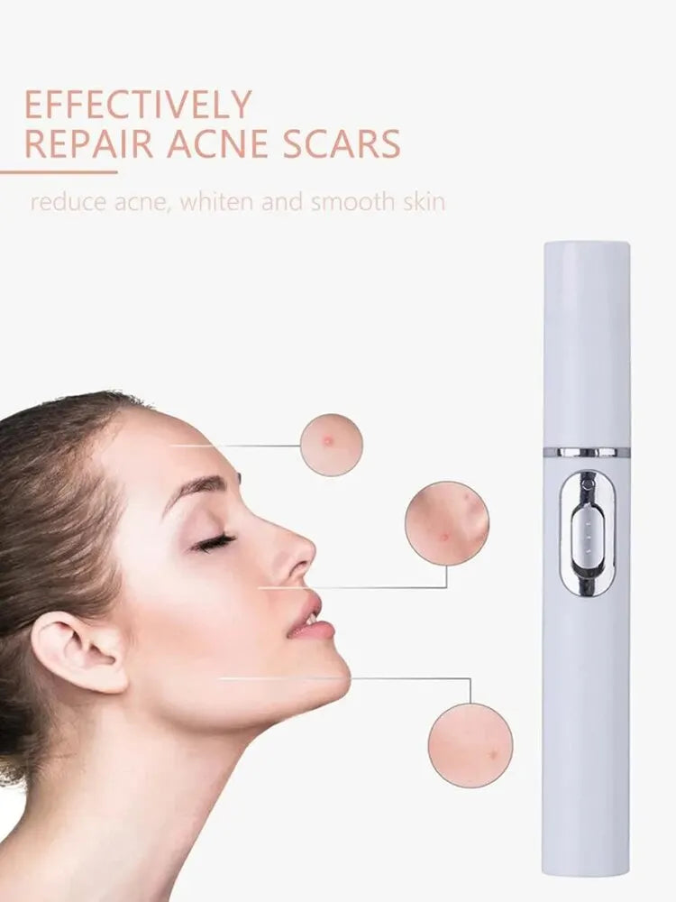 Facial Beauty Eye Massager – Blue Light Treatment for Dark Circles, Eye Bags & Skin Texture Improvement