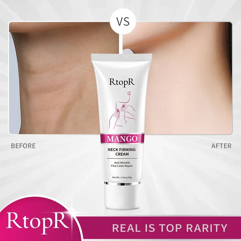 Rtopr Neck Cream — Reinforced Wrinkle Removal, Whitening & Moisturizing, Rejuvenating Neck Skincare