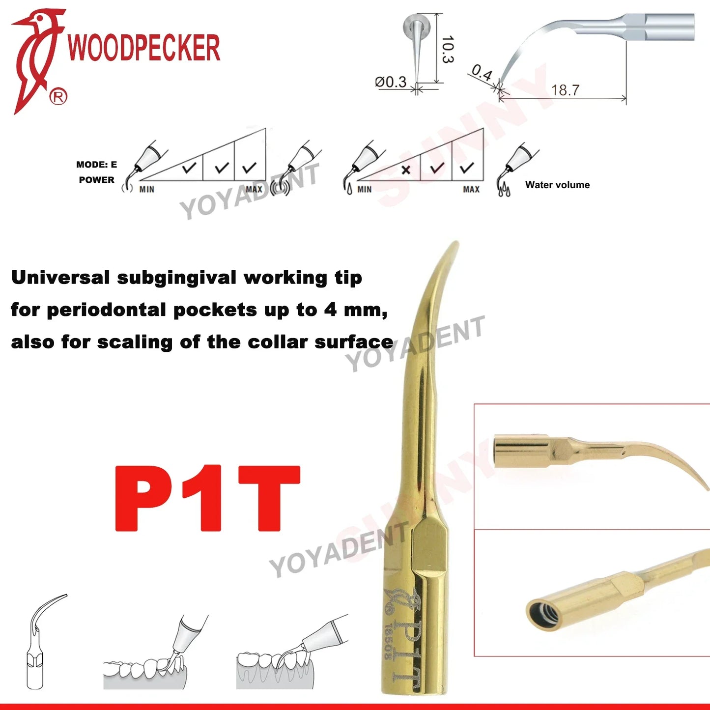 Woodpecker Dental Scaler Tips – Ultrasonic Tooth Cleaning, Endo & Perio Scaling Tips, Fit EMS UDS Scaler Handpiece