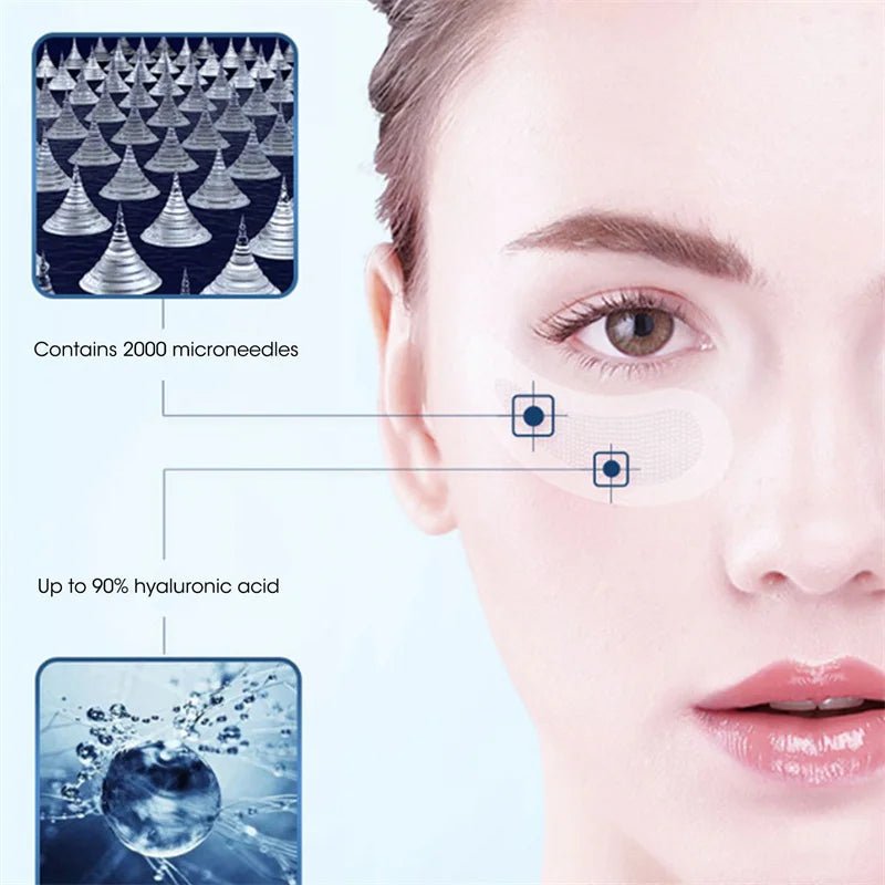 Micro-Needle Hyaluronic Acid Eye Patch – Anti-Wrinkle Moisturizing Eye Mask for Fine Lines Removal