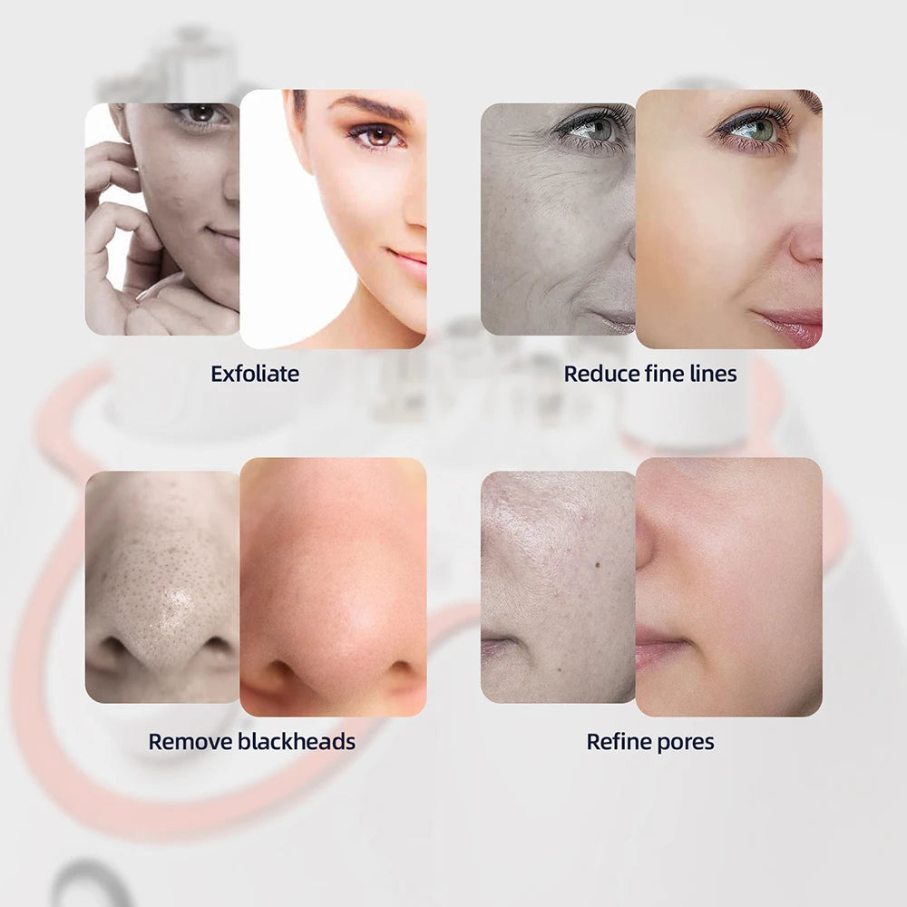 Professional Diamond Microdermabrasion Machine – At-Home Facial Peeling & Deep Cleaning Skin Care Tool