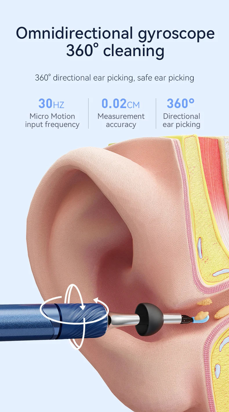 Visual Ear Cleaner with Camera – 12MP Ear Wax Removal Tool with Ear Pick, Tweezers & 6 Ear Spoons for Ear Care