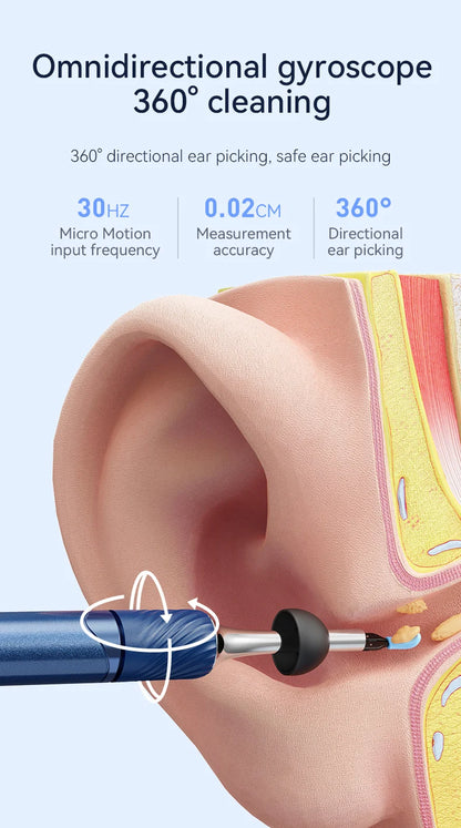 Visual Ear Cleaner with Camera – 12MP Ear Wax Removal Tool with Ear Pick, Tweezers & 6 Ear Spoons for Ear Care