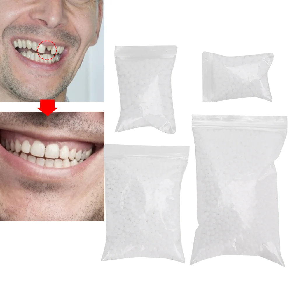 Temporary Tooth Repair Beads – DIY Dental Filling Material for Broken or Missing Teeth