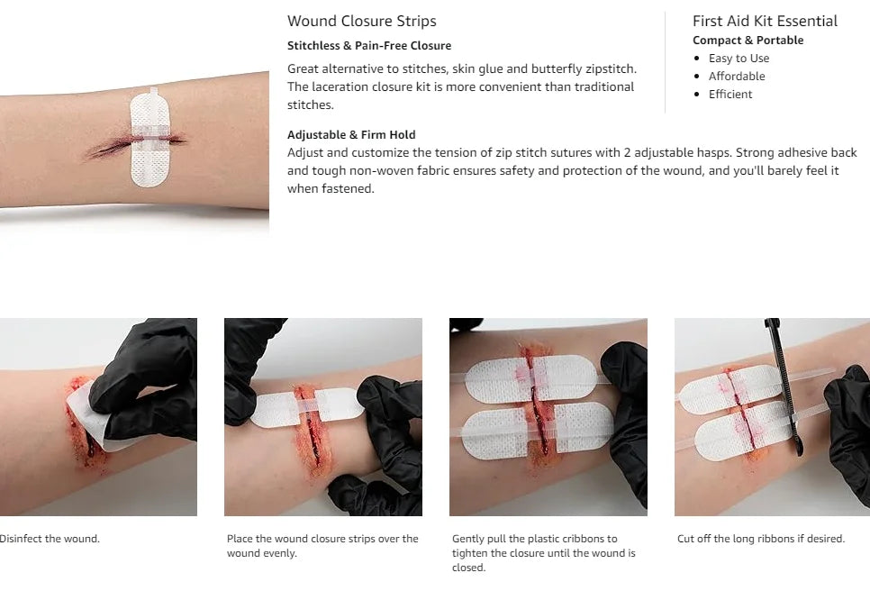 RHINO RESCUE Zip Stitch — Wound Closure Strips, Adhesive Bandages for Cut Care Without Sutures