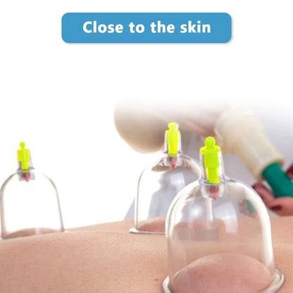 32 Pieces Professional Vacuum Acupuncture Cupping Massager Therapy Cans | Anti-Cellulite Suction Cups for Body Care