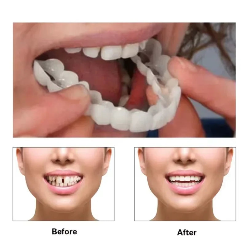 White Fake Teeth Cover – Whitening & Interdental Gap Decor, Portable Braces for Aesthetic Dental Beauty