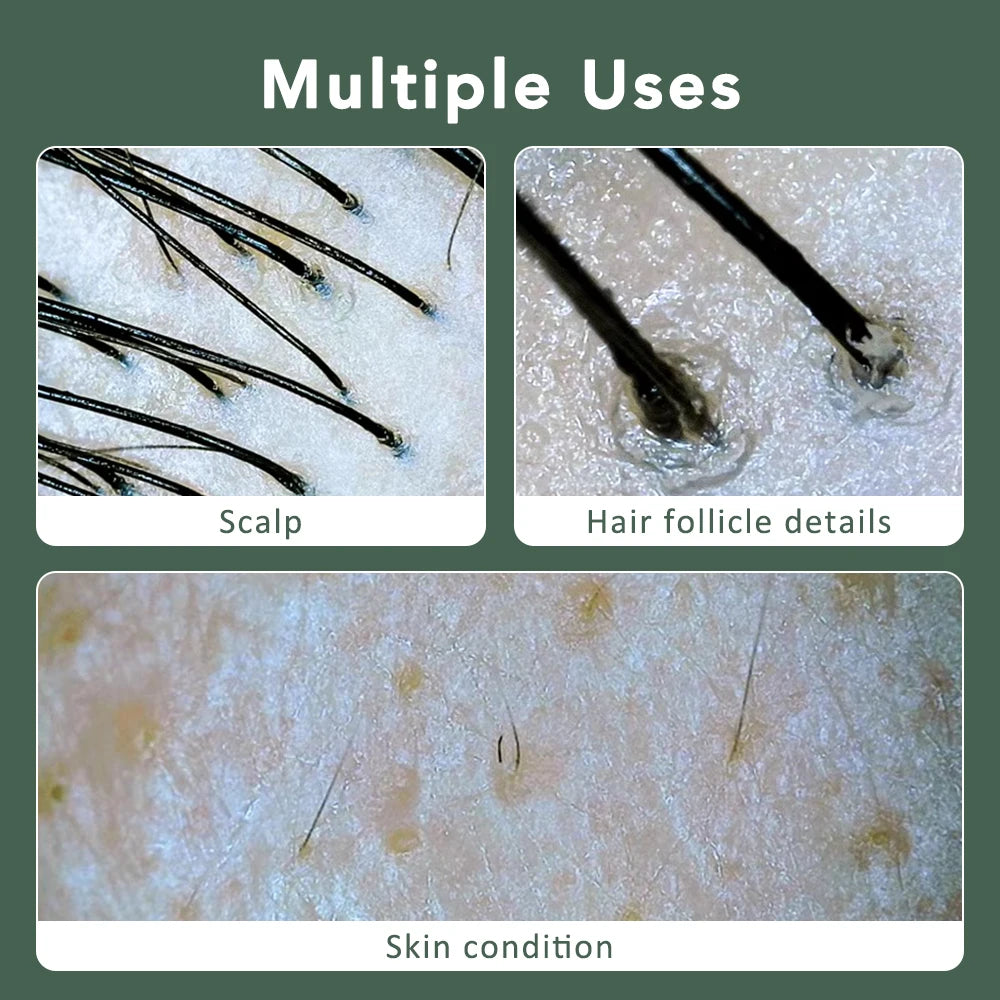 Wireless Dermatoscope Skin Analyzer — 1000X WiFi Magnifier for Scalp & Facial Skin Diagnostics