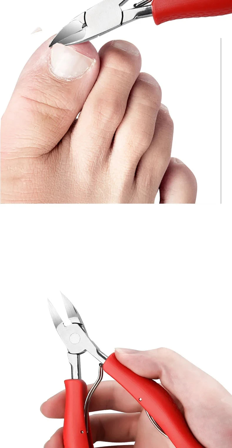 Nail Clipper Set for Ingrown Toenails — Paronychia Correction Nippers, Pedicure & Manicure Tools with Dead Skin Scissors