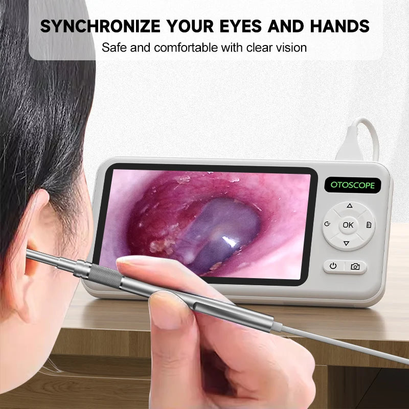 4.5-Inch HD Digital Otoscope - 1080P Ear Camera with 3.9mm Lens & 6 LEDs for Ear Wax Removal, Kids & Adults