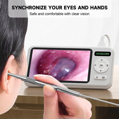 4.5-Inch HD Digital Otoscope - 1080P Ear Camera with 3.9mm Lens & 6 LEDs for Ear Wax Removal, Kids & Adults