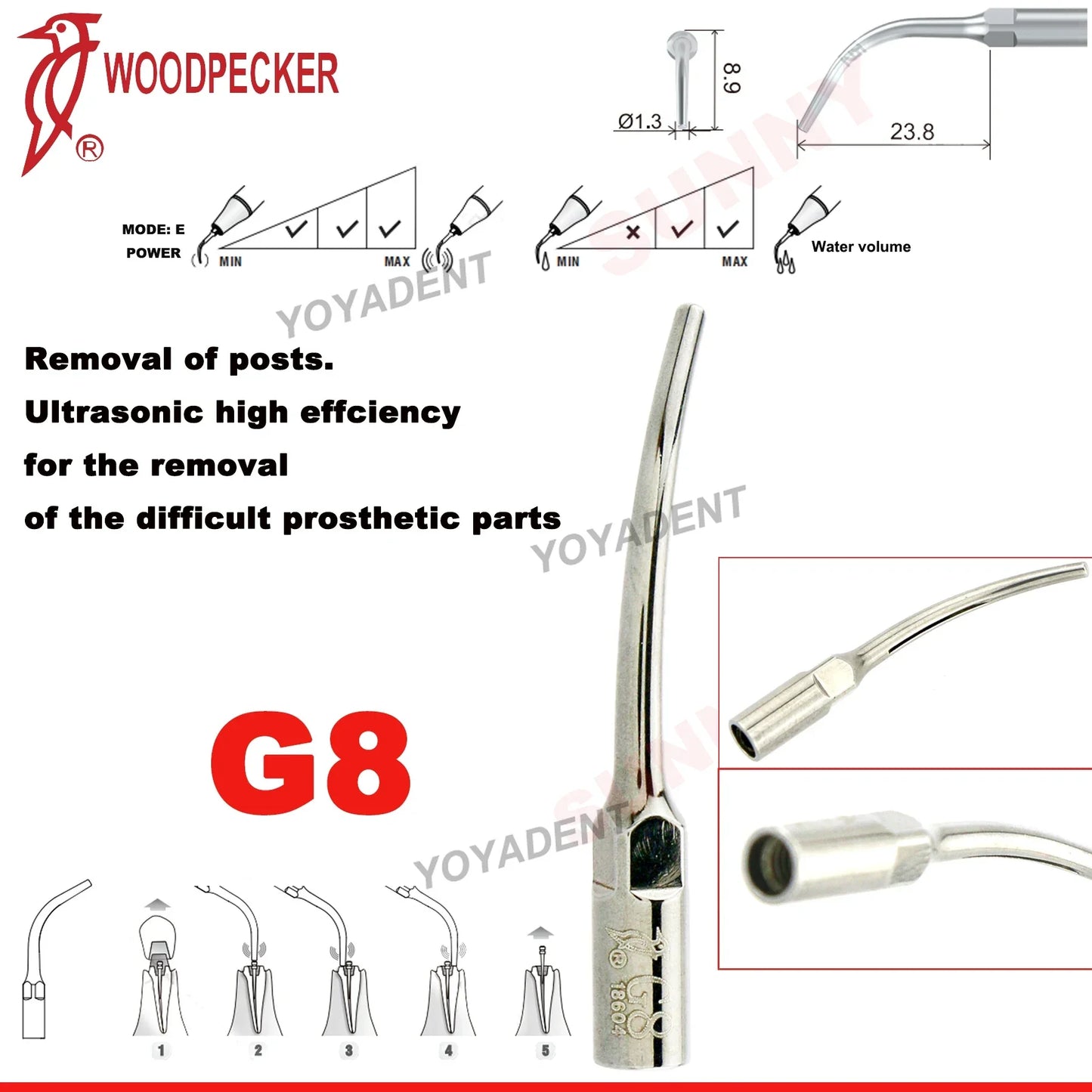 Woodpecker Dental Scaler Tips – Ultrasonic Tooth Cleaning, Endo & Perio Scaling Tips, Fit EMS UDS Scaler Handpiece