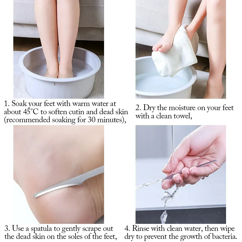 Stainless Steel Foot Callus Remover - Pedicure Exfoliating Scraper for Dead Skin and Callus Foot Care