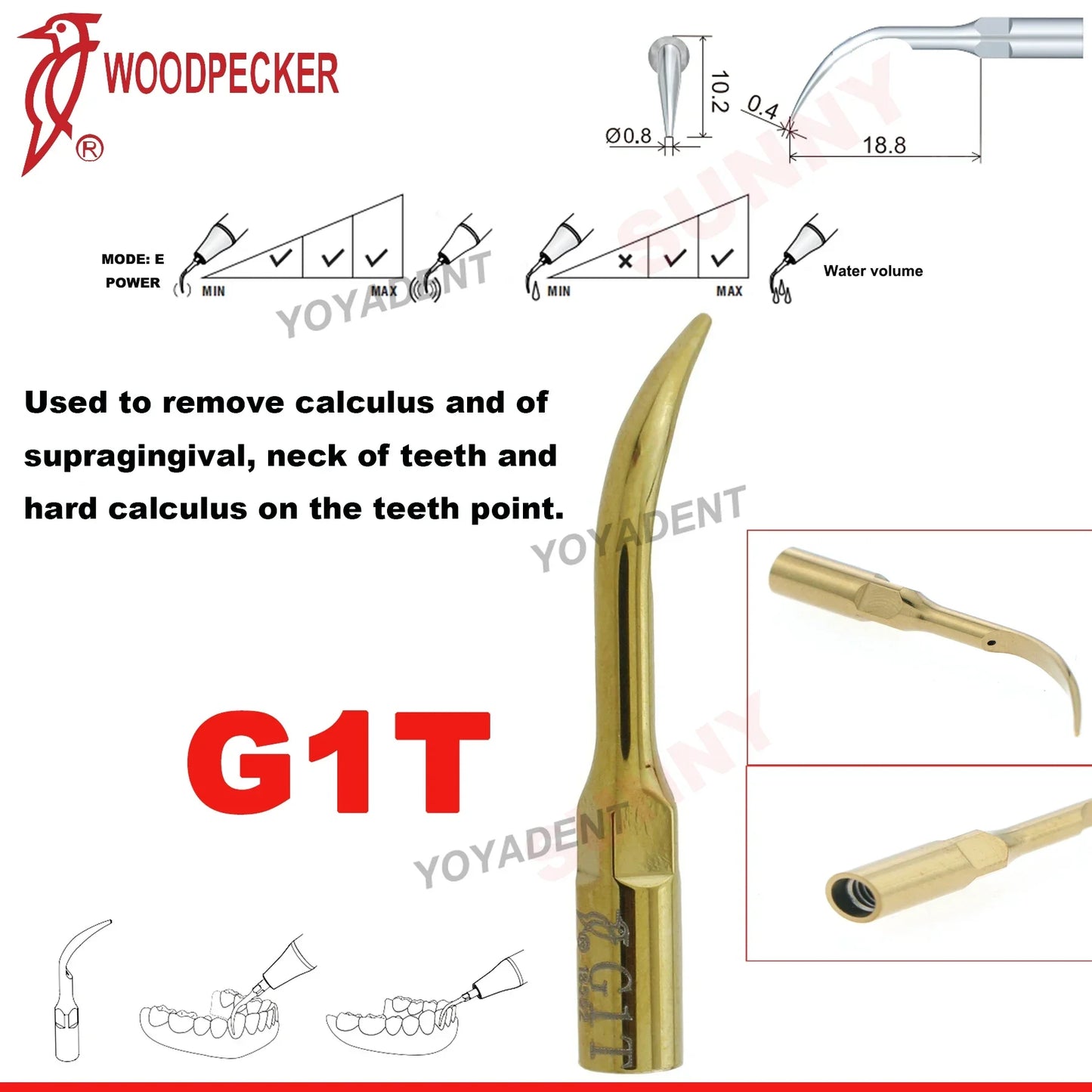 Woodpecker Dental Scaler Tips – Ultrasonic Tooth Cleaning, Endo & Perio Scaling Tips, Fit EMS UDS Scaler Handpiece