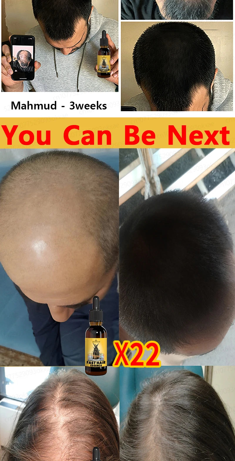 Rapid Hair Growth Serum – Beard, Chest & Body Hair Enhancer for Fuller, Thicker Growth
