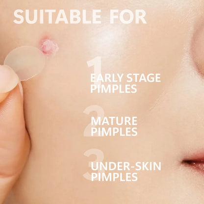 Microneedle Pimple Patches - 24-Pack Hydrocolloid Microdart Acne & Blemish Treatment Patches