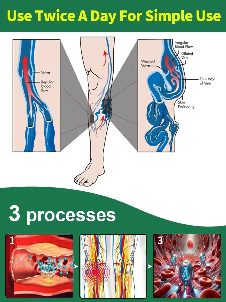 Medical-Grade Laser Treatment for Varicose & Spider Veins – Painless Leg Vein Therapy Equipment
