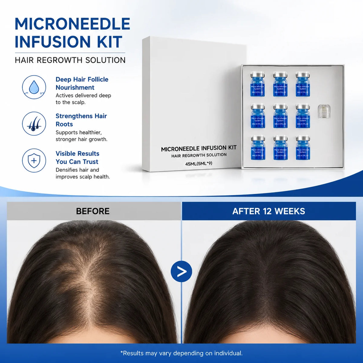 Microneedle Scalp Care Kit - Nourishing Serum & Hair Health Maintenance Tool
