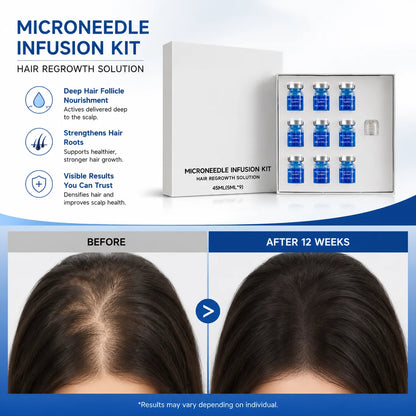Microneedle Scalp Care Kit - Nourishing Serum & Hair Health Maintenance Tool
