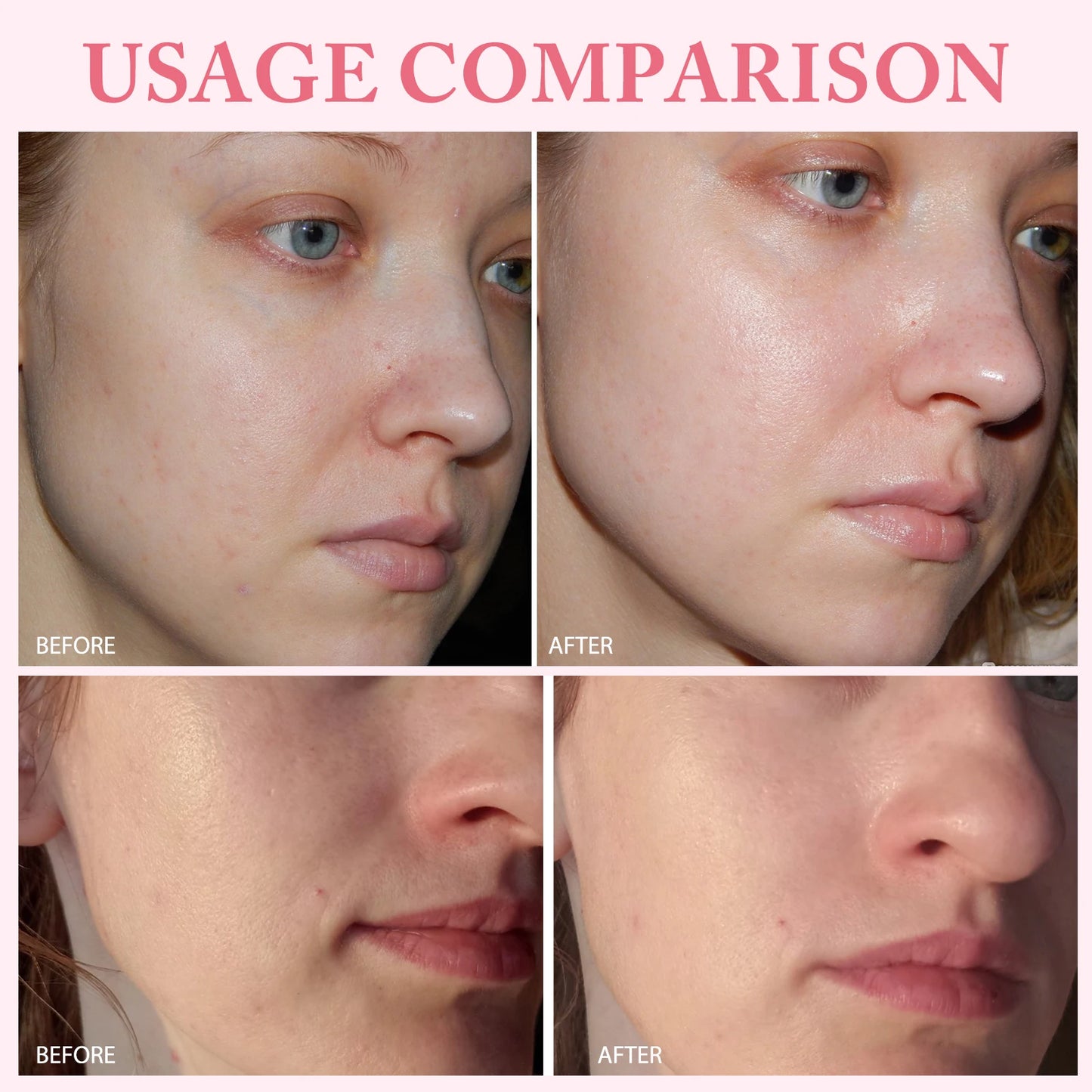 10pcs PDRN Pink One-Day Serum – Deep Moisturizing, Repairing, Brightening & Anti-Sagging Skin Care Essence