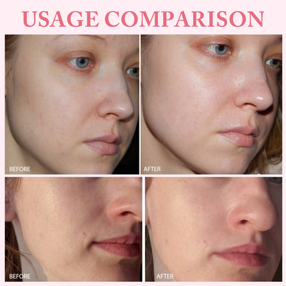 10pcs PDRN Pink One-Day Serum – Deep Moisturizing, Repairing, Brightening & Anti-Sagging Skin Care Essence