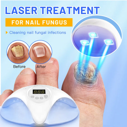 Fungal Nail Laser Device – Fast Toenail & Fingernail Fungus Repair, Onychomycosis Treatment for Hand & Foot Care