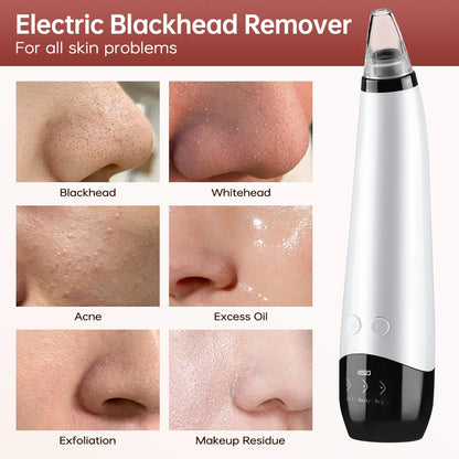 3-Mode Blackhead Remover Vacuum – Facial Pore Cleaner & Dead Skin Removal Beauty Tool