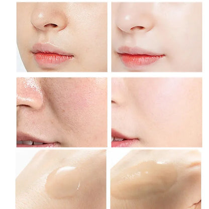 Salicylic Acid Peeling Serum - Pore Care, Blackhead & Blemish Treatment Facial Essence