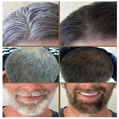 White Hair Killer – Gray Hair Remover & Natural Hair Color Restorer in 7 Days