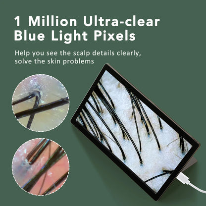 Wireless Dermatoscope Skin Analyzer — 1000X WiFi Magnifier for Scalp & Facial Skin Diagnostics