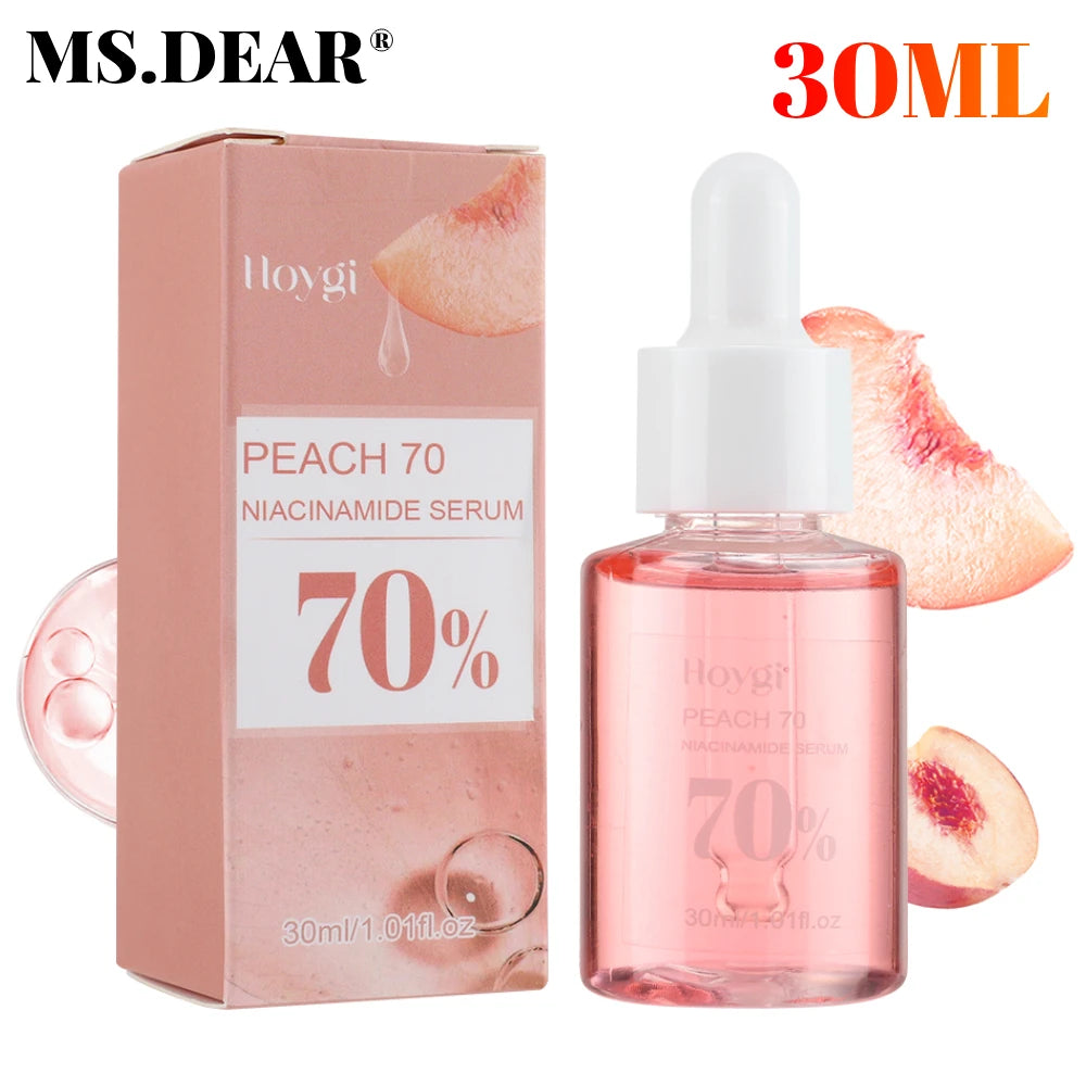 30ml Niacinamide Serum – Dark Spot Corrector, Melanin Removal & Pore-Shrinking Hydrating Skin Care