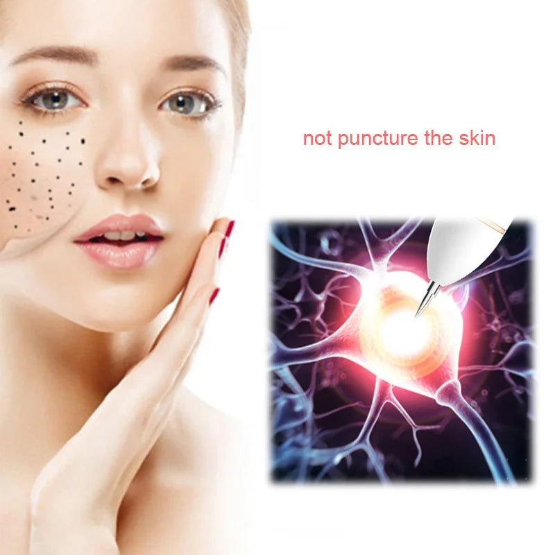 50/100pcs Sterile Surgical Needles for Mini Mole Removal Pen – Spot, Freckle & Plasma Point Beauty Accessories