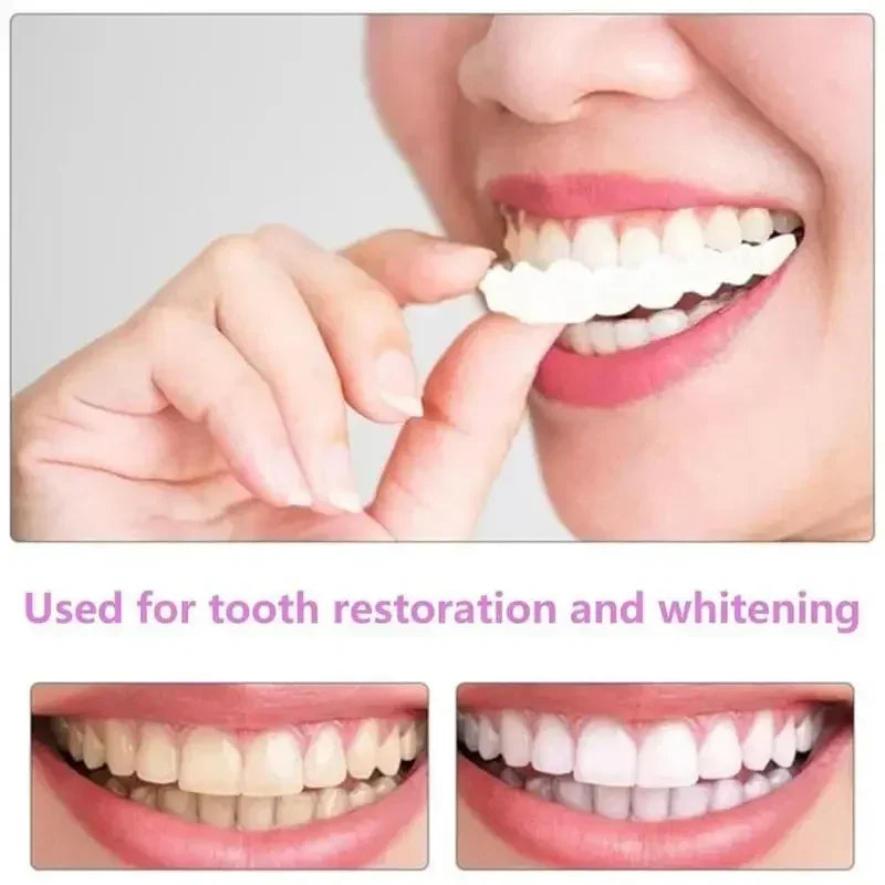2024 Adult Adjustable Dentures – Snap-on Fake Teeth Set for Gaps, Portable Braces & Oral Hygiene Care