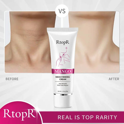 Rtopr Neck Cream — Reinforced Wrinkle Removal, Whitening & Moisturizing, Rejuvenating Neck Skincare
