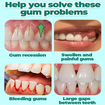 60ML Gum Repair Gel Serum - Sore Gum Relief Dental Care for Teeth Cleaning, Stains, Tartar & Oral Health