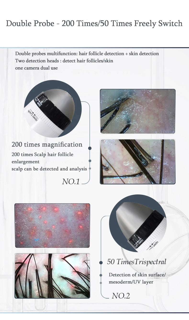 WiFi HD 5G Scalp, Skin & Hair Follicle Detector – 50X/200X Rechargeable UV Skin Analyzer Magnifier