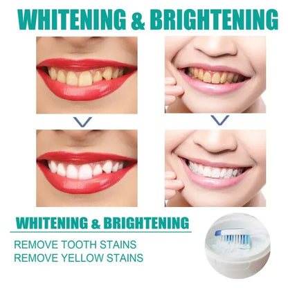 5 Day Teeth Whitening Powder – Removes Plaque & Stains, Deep Cleaning, Fresh Breath & Oral Hygiene Care