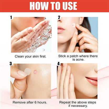 240Pcs Heart & Star Shape Acne Patches - High-End Pimple Dots for Moisturizing & Covering Zits and Blemishes