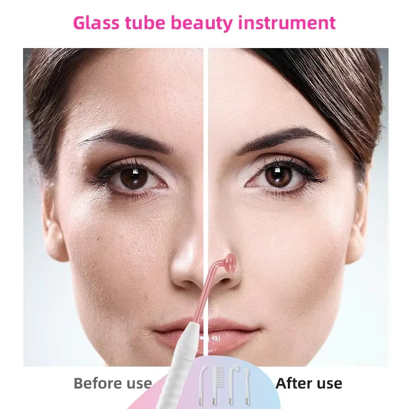 4 in 1 Electrode Glass Tube Machine - High Frequency Skin Spot Acne Wand for Facial Spa & Skin Care Electrotherapy