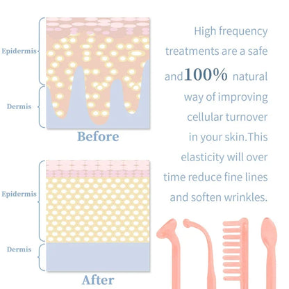 4-in-1 Handheld Electric Facial Therapy Wand – High Frequency Skin Beauty Tool for Acne Treatment and Skin Care