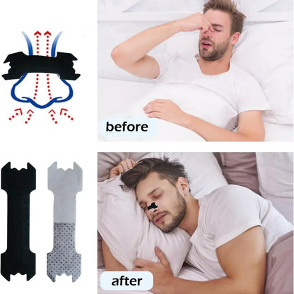30/60/90PCS Anti-Snoring Nose Patch Set – Extra Strength Nasal Strips for Better Breathing & Sleep Aid