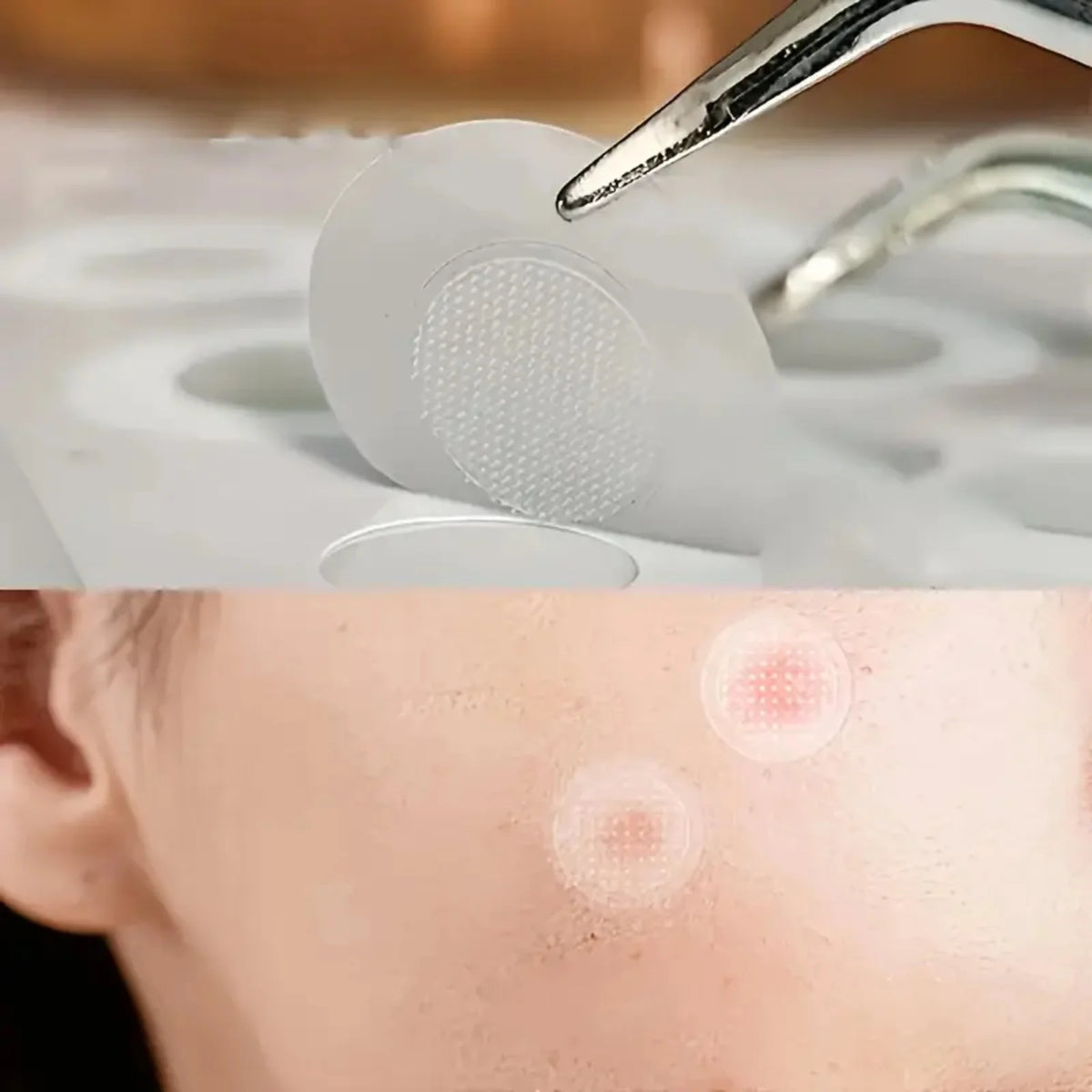 24-Piece Hydrocolloid Acne Patches - Individually Packaged Waterproof, Oil-Absorbing Spot Covers for Daily Skincare