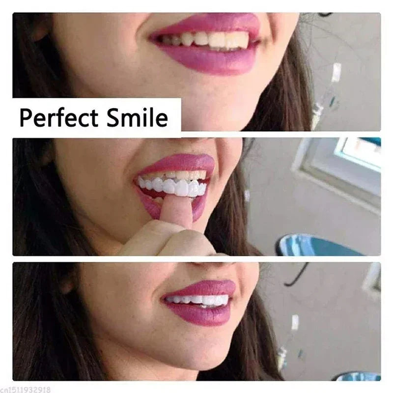 Silicone Denture Set – Temporary Orthodontic Teeth, Fake Teeth for Oral Hygiene, Whitening, and Dental Braces Simulation