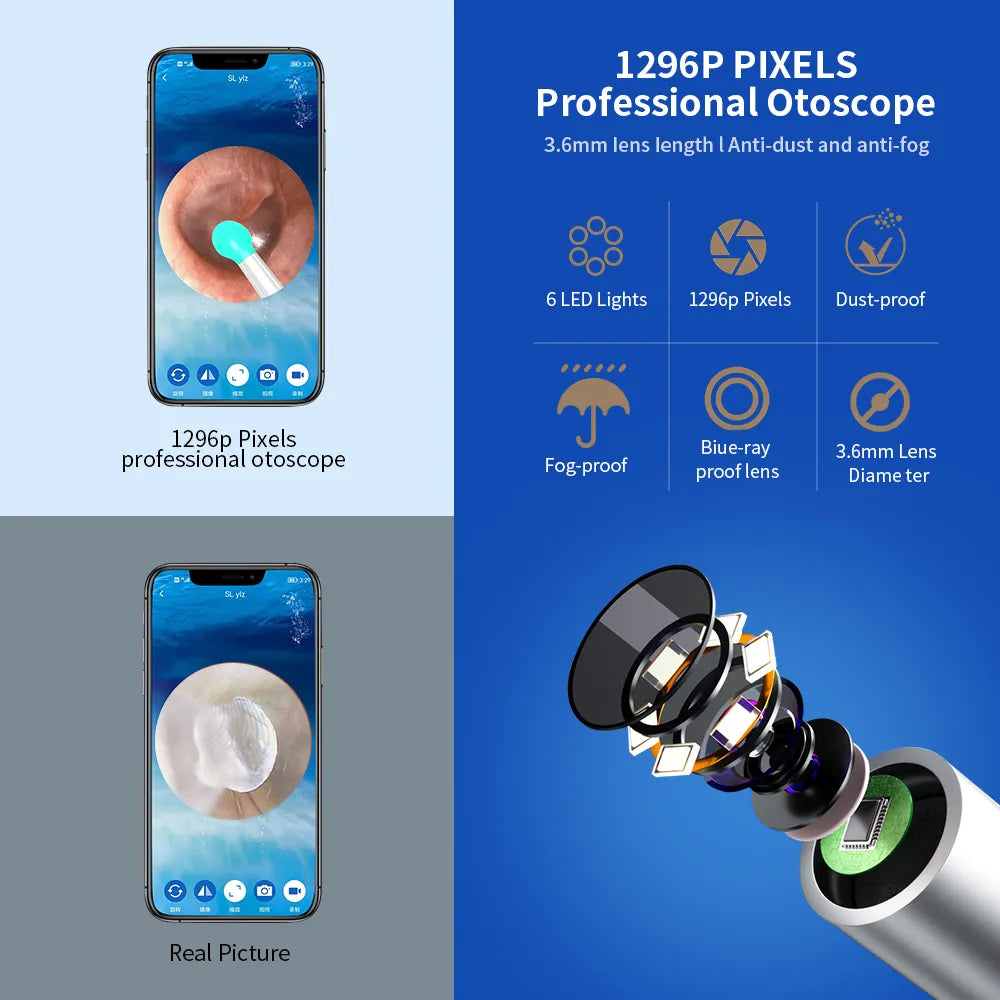 NATFIRE NE3 Ear Cleaner - High Precision Wireless Otoscope with Camera and LED Light - Smart Ear Wax Removal Tool Kit