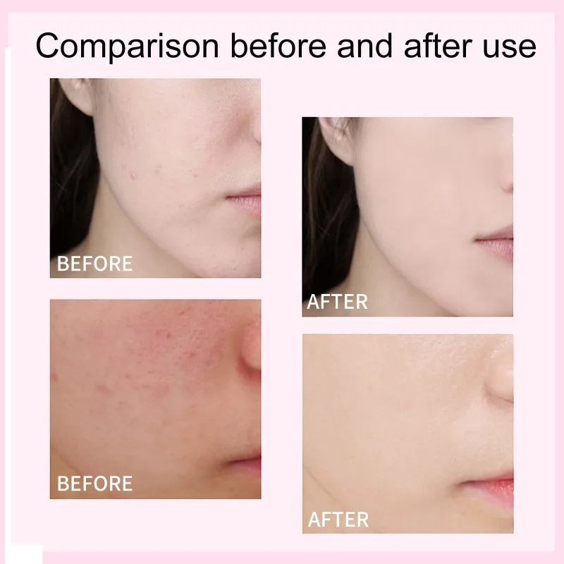 CC Foundation Cream – Natural Moisturizing, Waterproof, Brightening Concealer with Oil-Control & Long-Lasting Coverage
